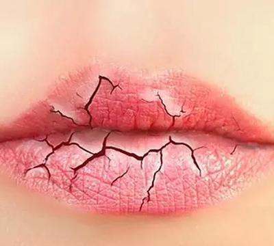 嘴巴干嘴唇干裂涂唇膏有用吗 唇膏有什么作用？